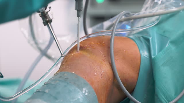 Best Knee Arthroscopy Surgeon in Thane