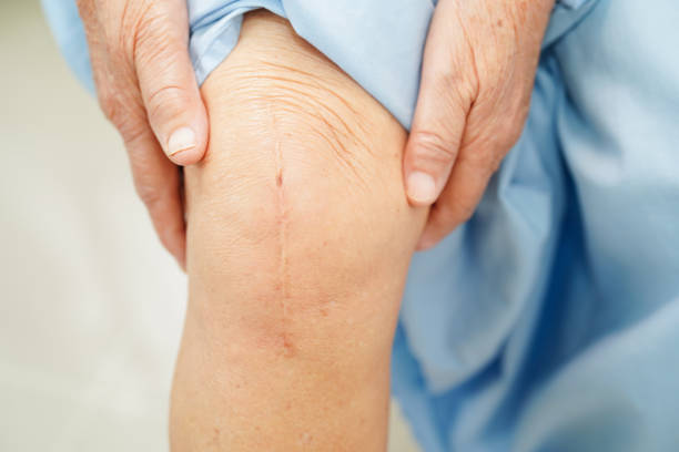 knee replacement surgeon in thane