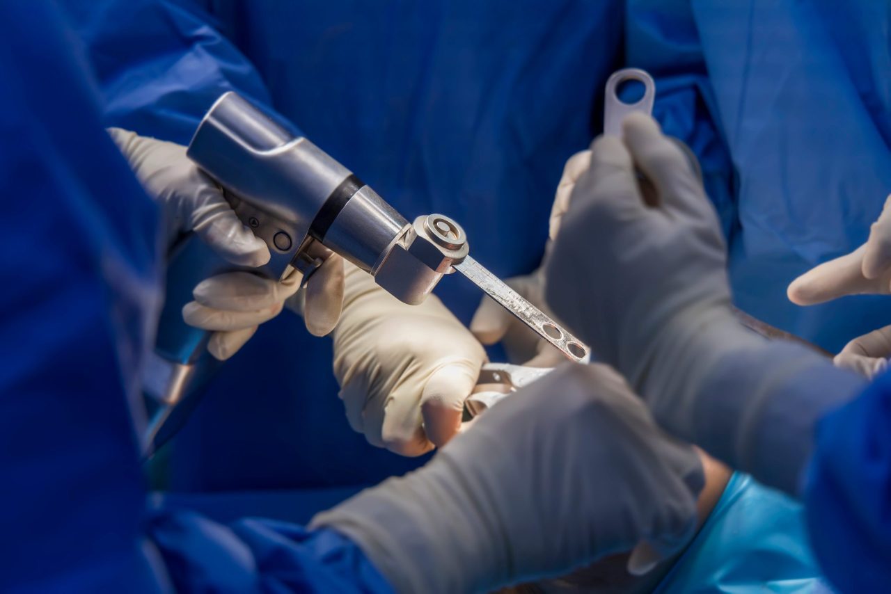 best-robotic-knee-replacement-surgeon-in-thane